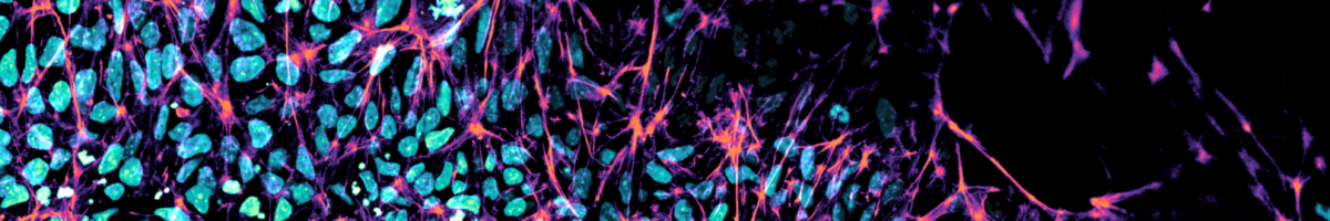 Composite_FaCellitate_warm_cold_4