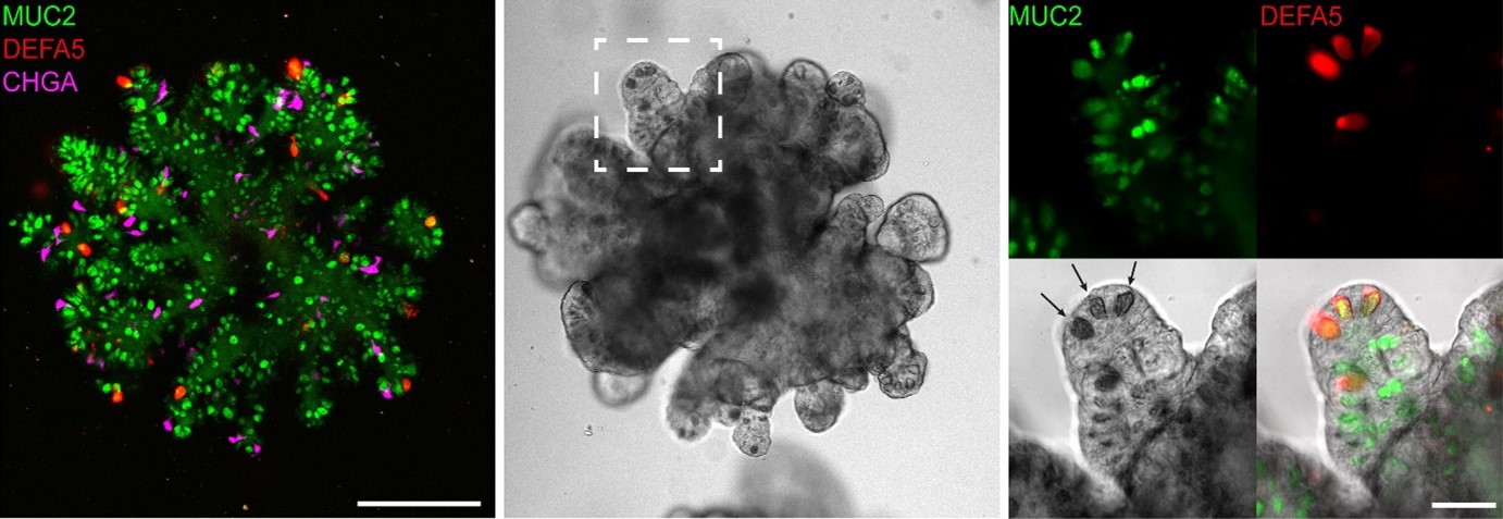 organoids